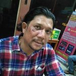 SMSI Pusat Desak Polisi Usut Kasus Penganiayaan Ketua SMSI Madina Terkait Pemberitaan