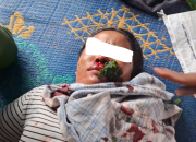 Pekerja dan Sekurity PT TPL Diduga Serang Masyarakat Adat Sihaporas, 5 Warga Luka-Luka