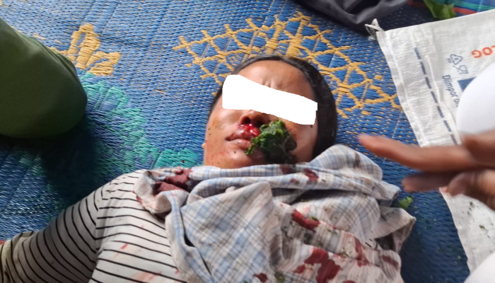 Pekerja dan Sekurity PT TPL Diduga Serang Masyarakat Adat Sihaporas, 5 Warga Luka-Luka